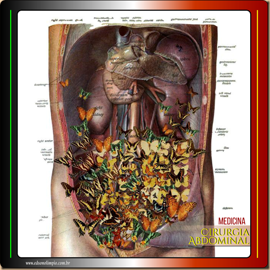 Med Cirurgia Abdominal